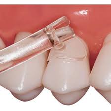 Cure-Thru Cervical Matrice Premolar 150/Bx Premier Dental (9061017)